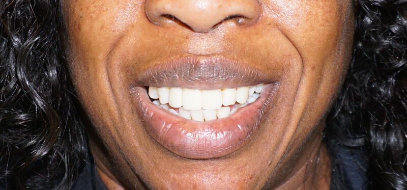 Happy patient at Allstate Dental